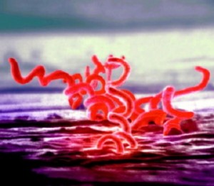 sifilide veicolata dal batterio Treponema pallidum