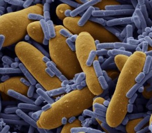 Batteri-non-patologici-nelle-urine