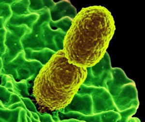 Klebsiella infezioni urinarie